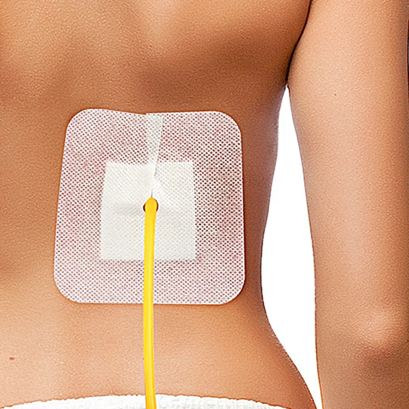 5/10Pcs Drainage Tube Sterile Applicator   Catheter Bile Duct Nephrostomy Gastric Tube With Hole Sticker Fixed
