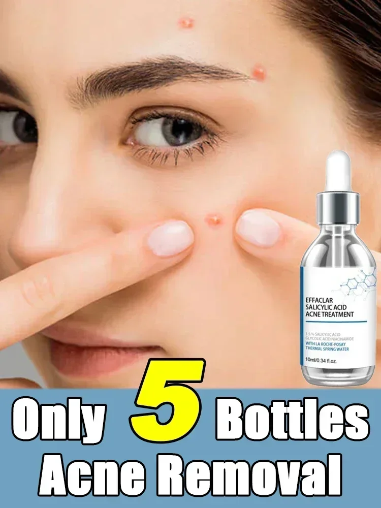 

Salicylic Acid Solution Essence Shrink pores and Acne Spot Removing Shrink Pores Oil-Control Brighten Face Skin Makeup