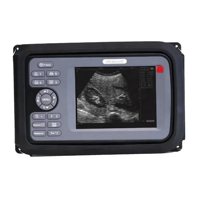 

hand held veterinary ultrasound scan handscan for dog cat can be with abdominal probe ultrasonic