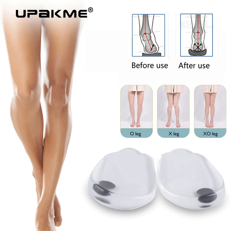 2PCS Insoles Correction Shoes Inserts Pads Effective O/X Type Leg Bowed Legs Knee Valgum Straightening for Women Men Health Care