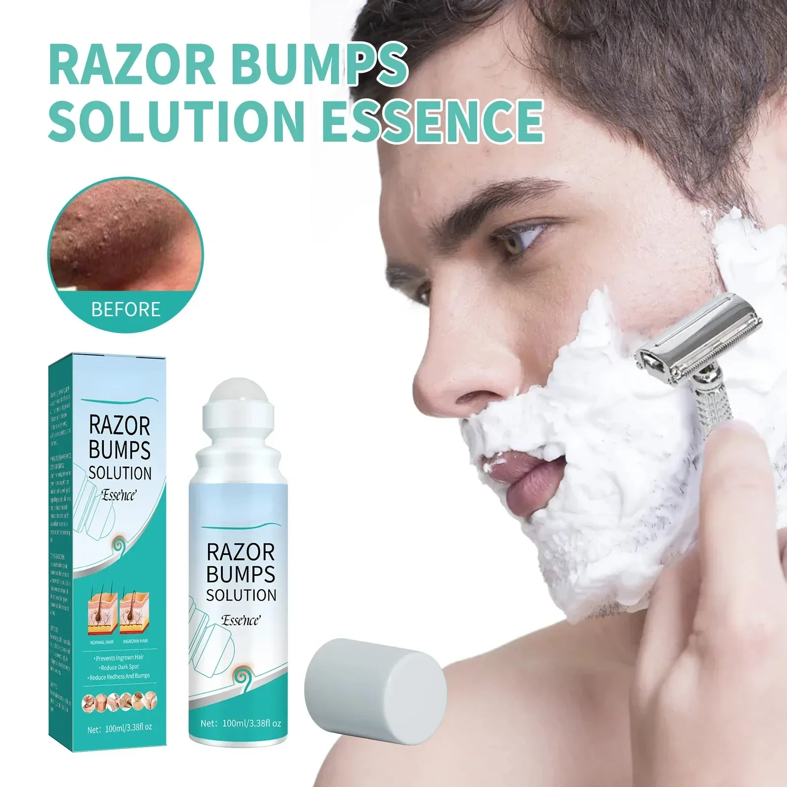 

After Shave Serum Razor Bump Stopper for Men Women Waxing Ingrown Hair Remover Reduce Redness Skin Soothes Moisturizes Solution