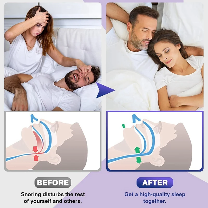 Dispositivi antirussamento, tappo antirussamento con magnete regolabile, soluzione antirussamento per un sonno confortevole e silenzioso, 8 pezzi