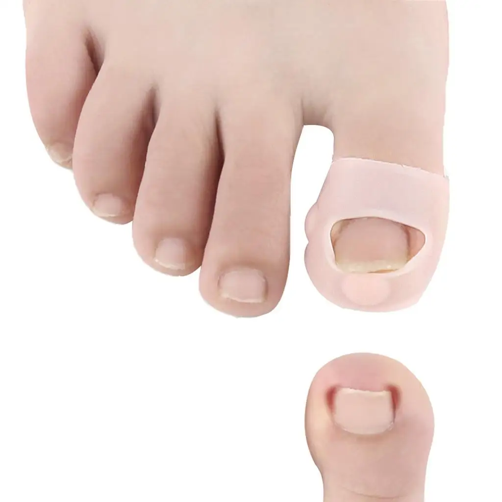 10 ชิ้นคุด Toenail Corrector เล็บเท้าสําหรับผู้ชายผู้หญิง