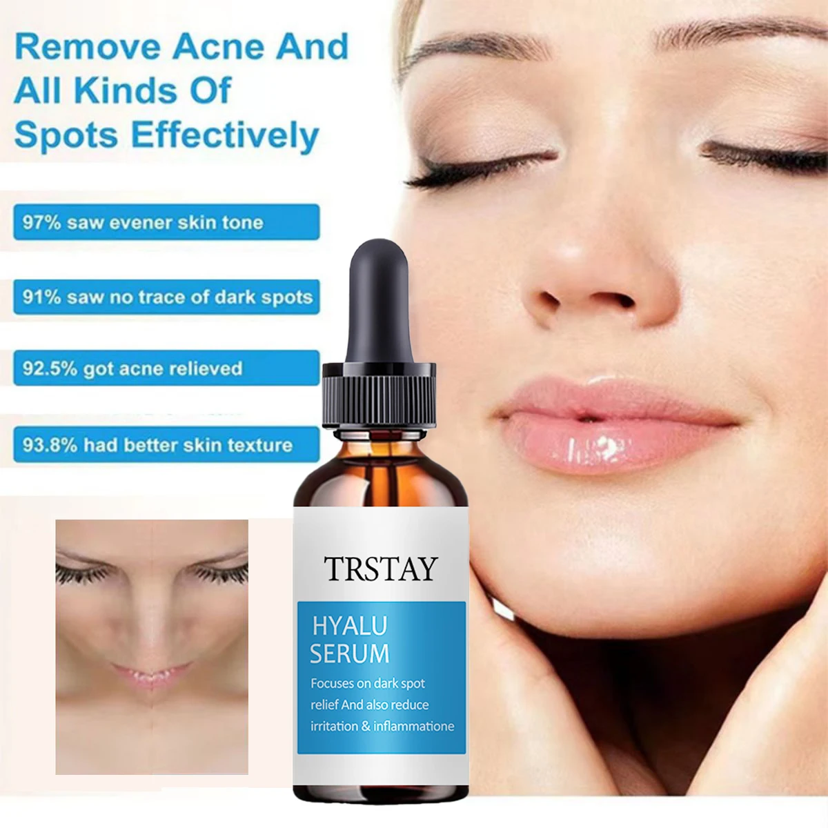 TRSTAY facial essence focuses on reducing black spots and irritation and inflammation