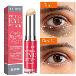 Anti Aging Lifting Firming Retinol Anti-Wrinkle Eye Cream Remove Eye Bags Dark Circles Whitening Moisturizing Brighten Skin Care