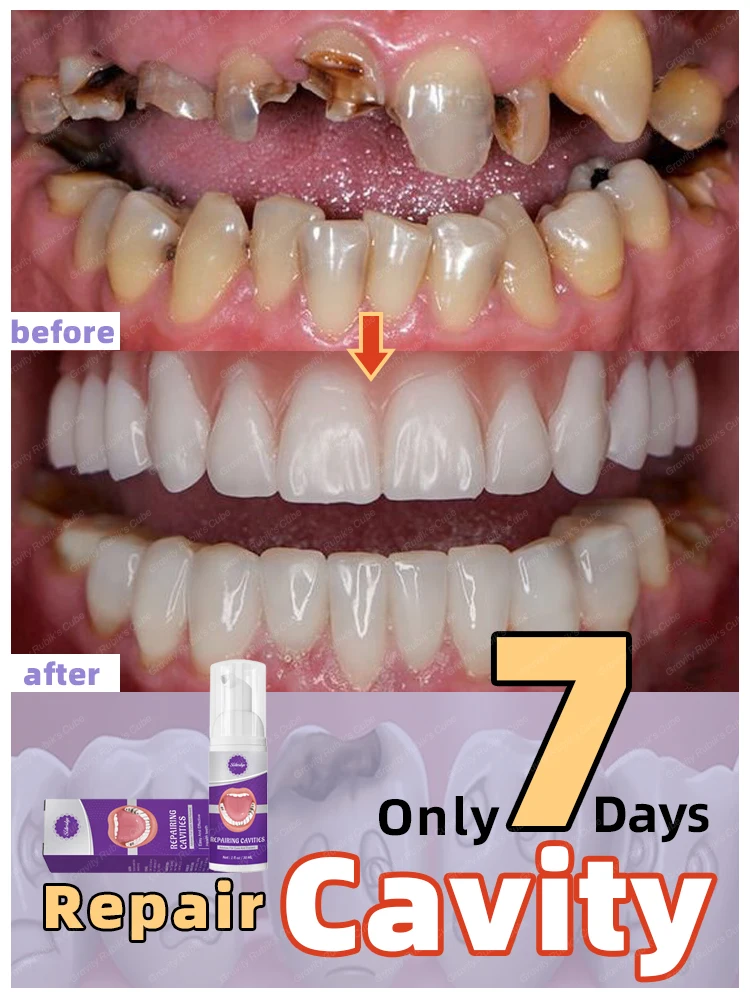 Fast prevent tooth decay, whiten teeth, and freshen breath