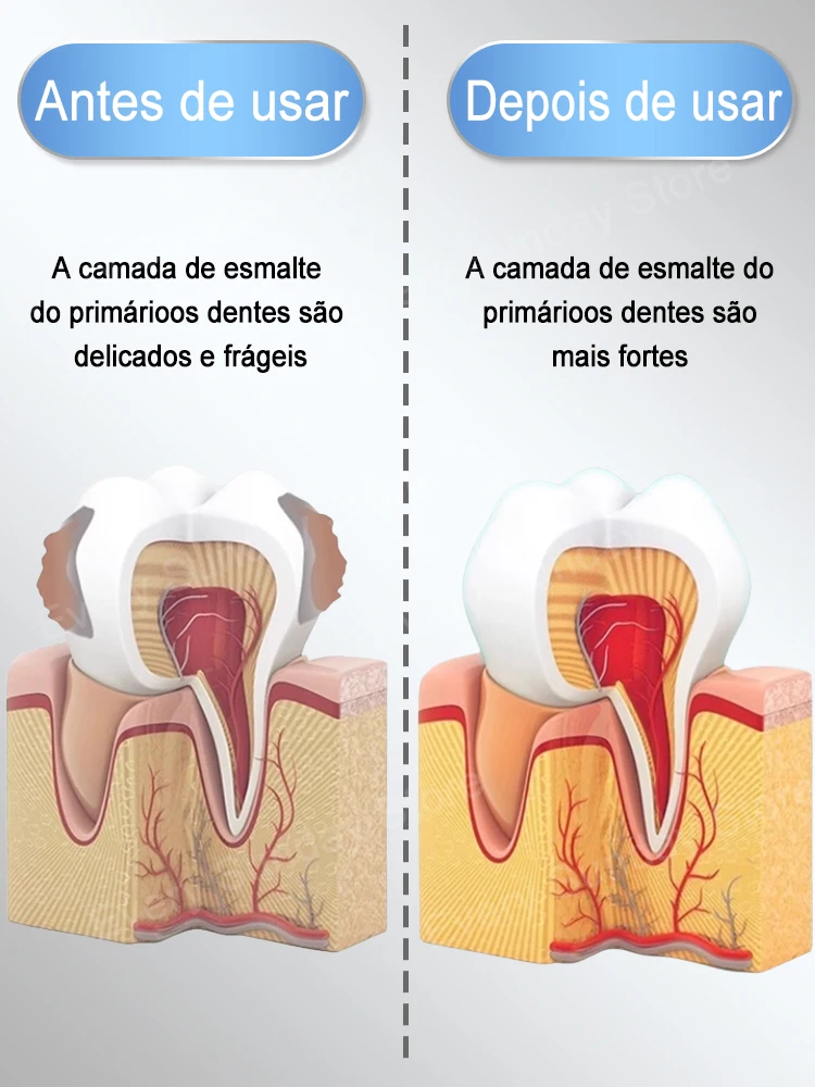 Producto vendedor caliente, el 99% de los compradores compran de nuevo, los dientes son mejor