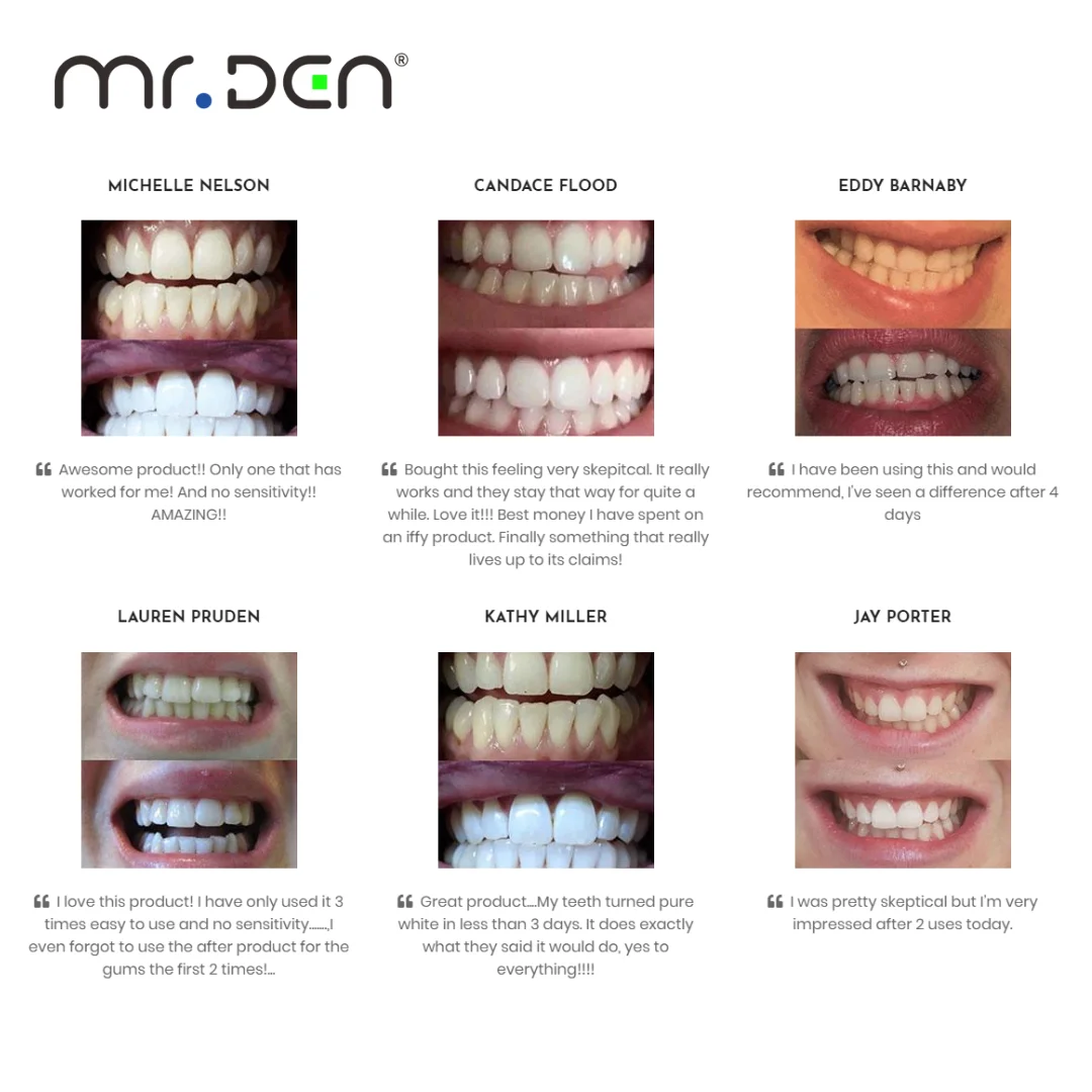 Dr. Whiten 3 Pack Teeth Whiten - đánh giá và giá Teeth Whitening China