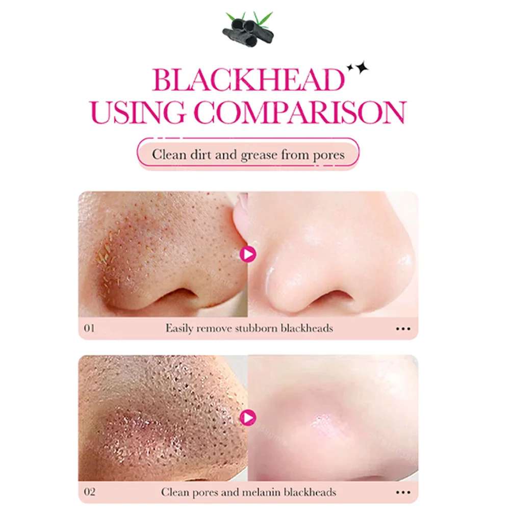 Patch per il naso per pulizia profonda al carbone di bambù Rimuovi rapidamente punti neri e comedoni Adesivo nasale per strappare i pori restringenti