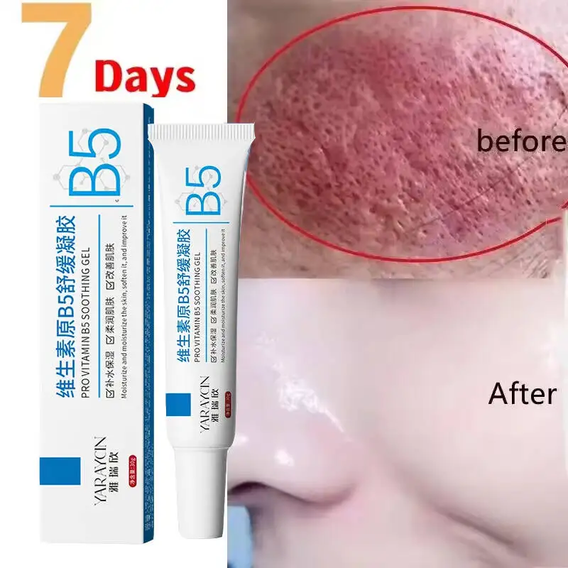 Facial Redness Repair Cream Improve Sensitive Skin Dryness Moisturizer Hydrating Sooth Lotion Removal Rosacea Korean Cosmetics