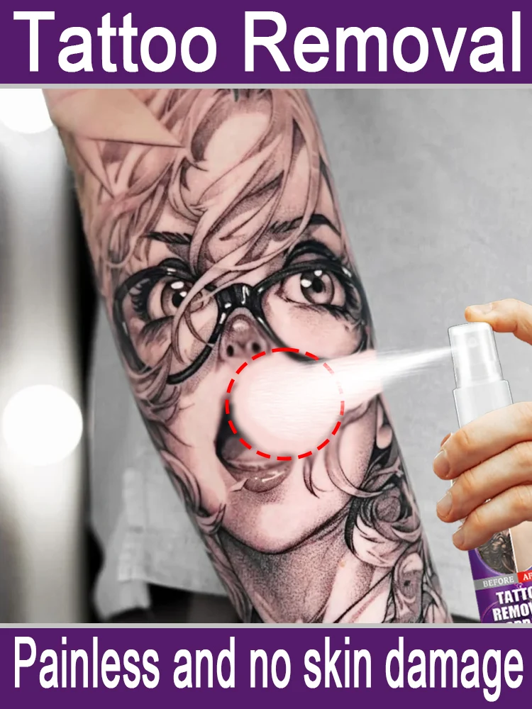 

100% tattoo removal, painless and no skin damage