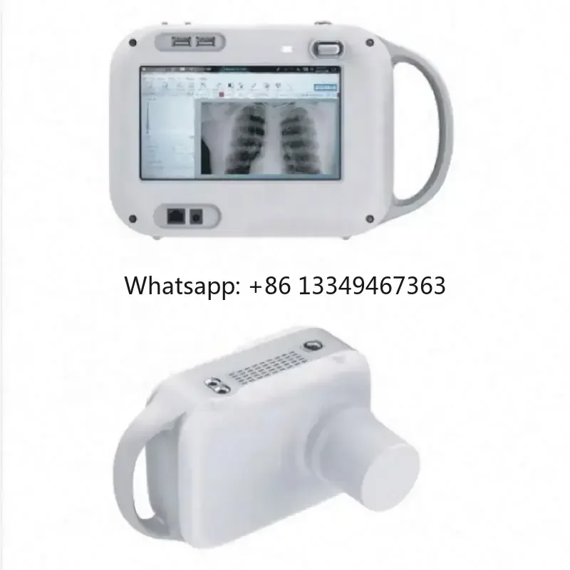 

Manufacturer Portable Xray Machine Medical X-ray/Handheld DR for Radiography X Ray Diagnosis Factory