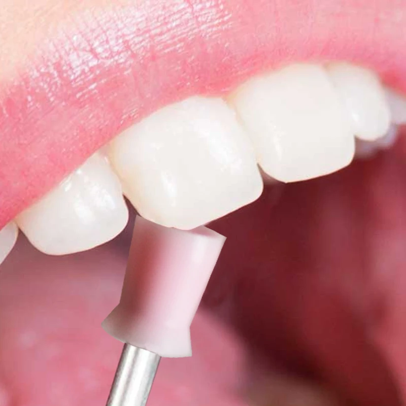 100 قطعة من أكواب فرشاة تلميع خلط الأسنان، مجموعة من الفولاذ المقاوم للصدأ ذات نهاية مسطحة/حادة #3