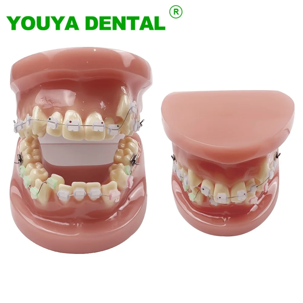 Dental Demonstration Model Orthodontic Treatment Teeth Model With Ceramic Brackets For Patient Education Studying Teaching Tools