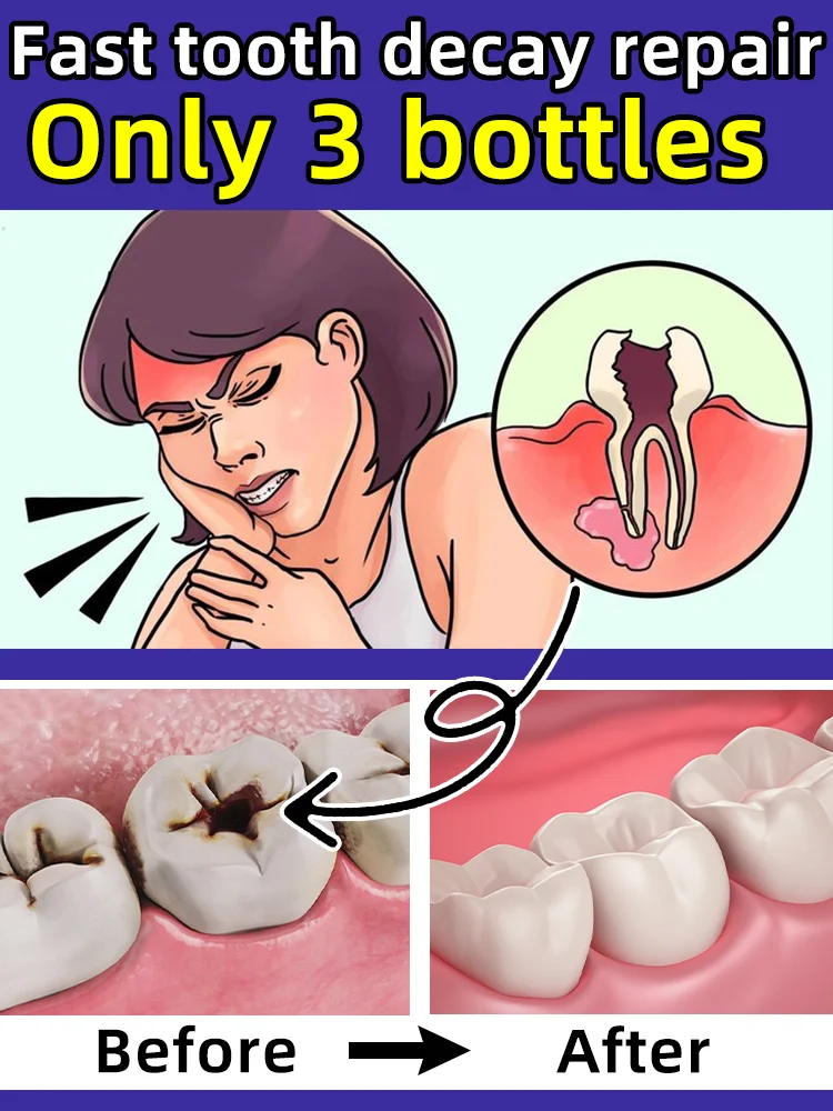 Fast Solves the caries and tooth decay problem