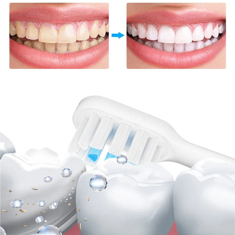 4/8 Uds. Para uso con XIAOMI MIJIA T700 cabezal de cepillo de dientes eléctrico sónico cabezales de cepillo de repuesto de cerdas suaves con tapas paquete sellado