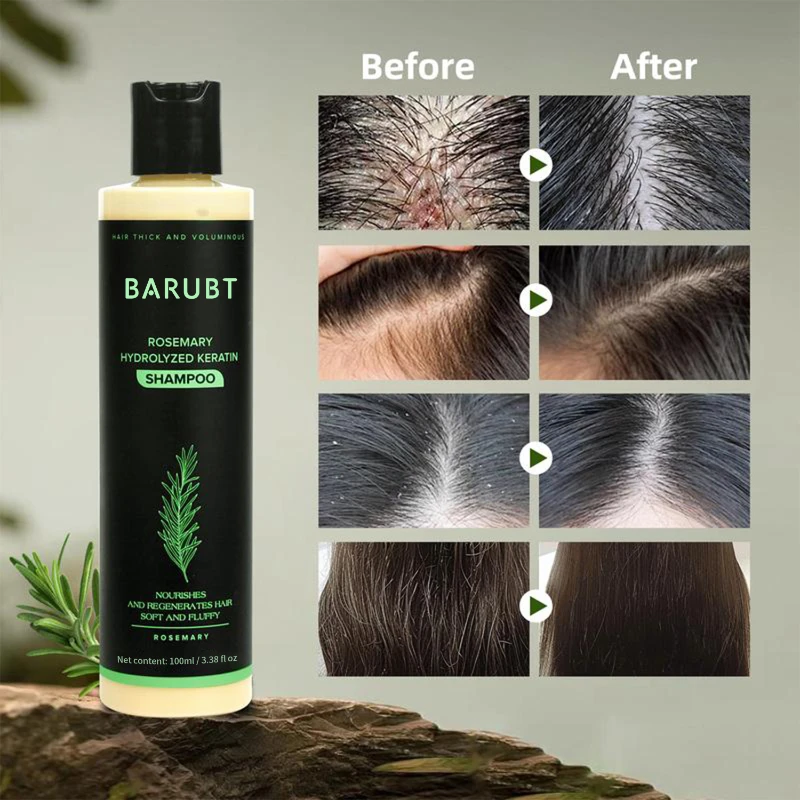Hair Growth Shampoo With Rosemary, Strengthening Anti-hair Loss Formula, Botanical Oil Control For Fluffy Refreshed Hair 100ml
