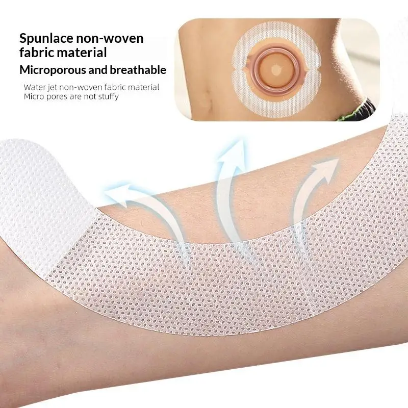 10 Bandes de protection élastiques pour stomie en tissu non tissé Spunlace, adhésives, anti-fuites, pour sac de colostomie