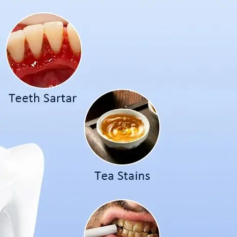 Ультразвуковой стоматологический скалер, очиститель зубов, удаление зубного камня, электрический звуковой инструмент для удаления зубного налета, зубной камень
