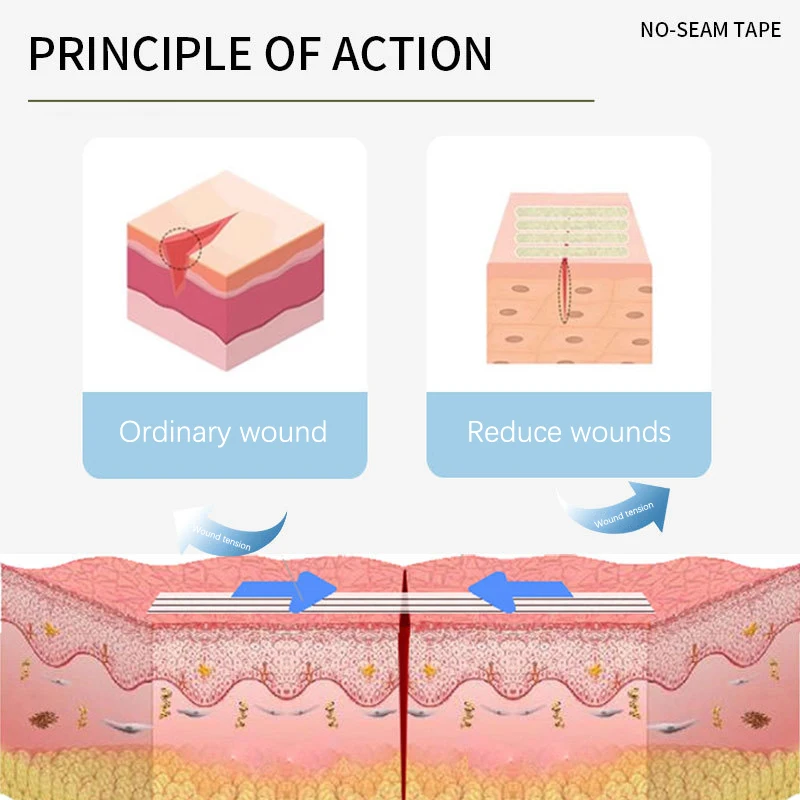 Cinta adhesiva sin costuras, tela no tejida para la piel suave y agradable, ajuste transpirable, reducción de tensión física, vendaje autoadhesivo