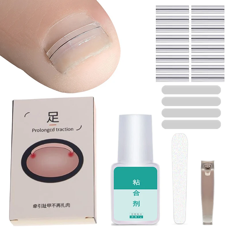 Ingrown Toenail Correction Tool Ingrown Toe Nail Treatment Elastic Patch Sticker Straightening Clip Brace Pedicure Tool