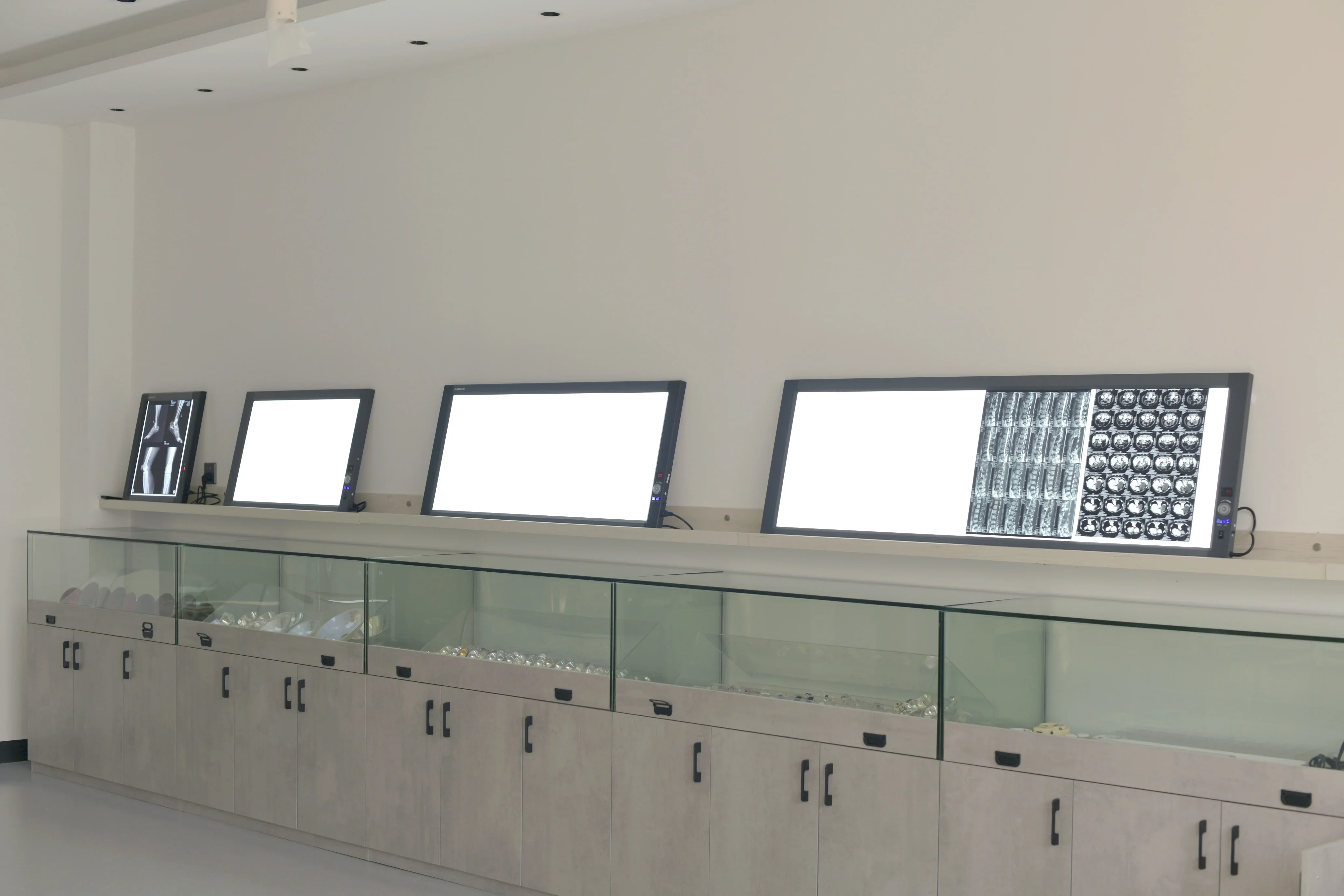 Medical Led X Ray Film Viewer Single X-ray Film Viewing Box New Type Medical X-ray View Box  Negatoscope