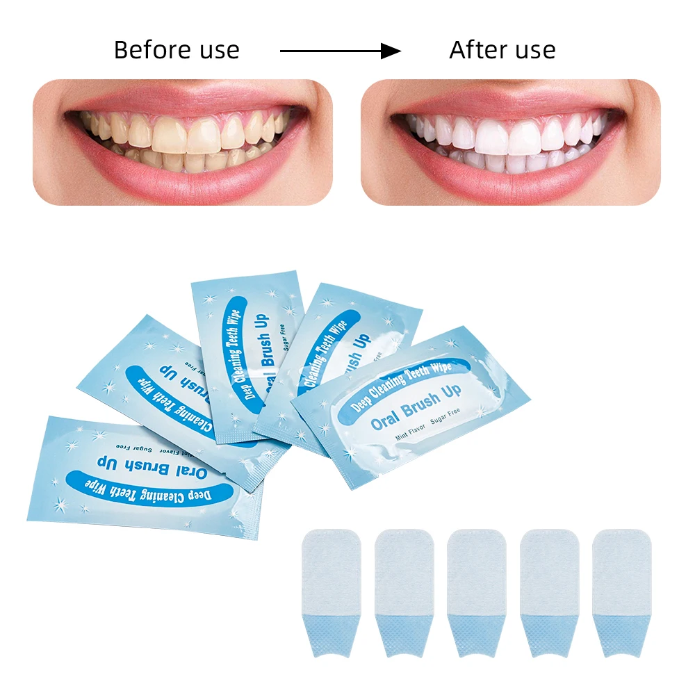 

200pcs Disposable Mint-Flavored Teeth Cleaning Wipes Finger Wipes Oral Hygiene Care Tools Independent Packaging