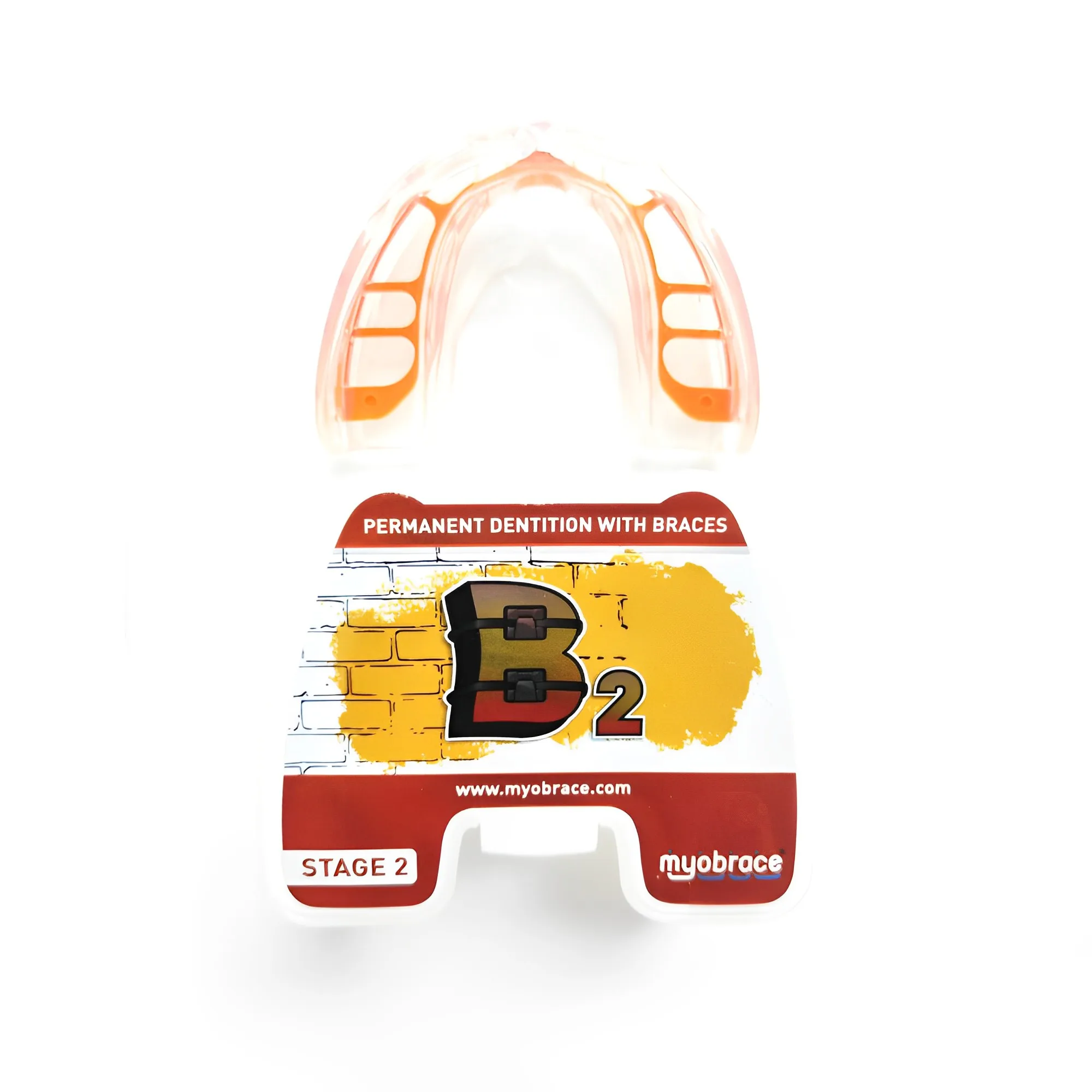 

MRC Orthodontic Trainer B2 Orthodontic Brace MRC Dental Fender Trainer B2 Progresses To Maxilla