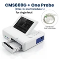 Single fetal set