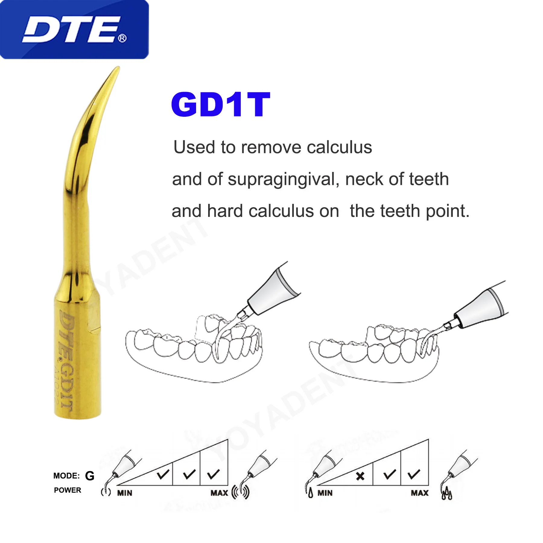 Embouts de détartreur dentaire, calcul, Pic DTE, Embouts de détartrage, Pièce à main plaquée Ti, GD1T, Fit NSK, SATELEC, Livres de dents