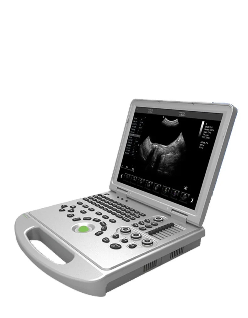 Mid-level portable type ultrasound diagnostic system ultrasound scanner with 4D image