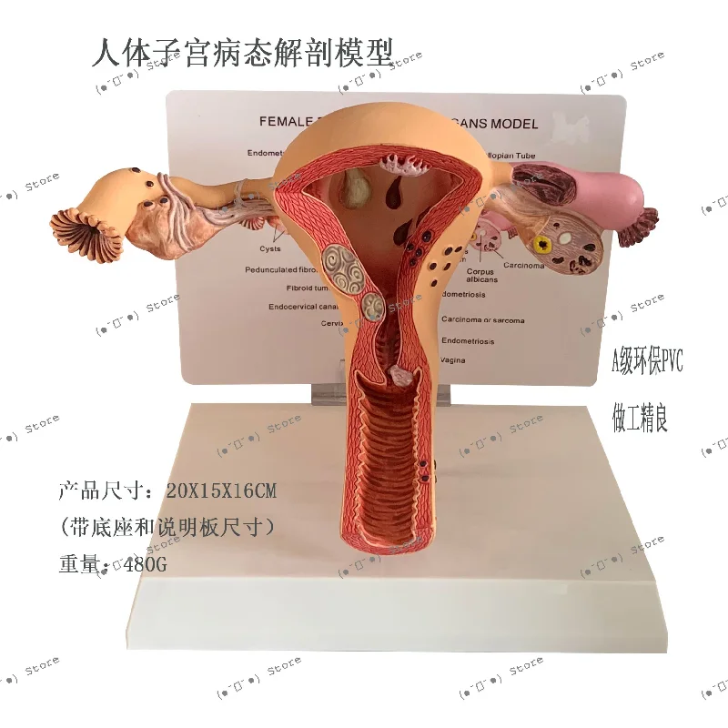 

Модель анатомии матки, маточная трубка, женское влагалище, яичники, учебное пособие, шейка матки/рак