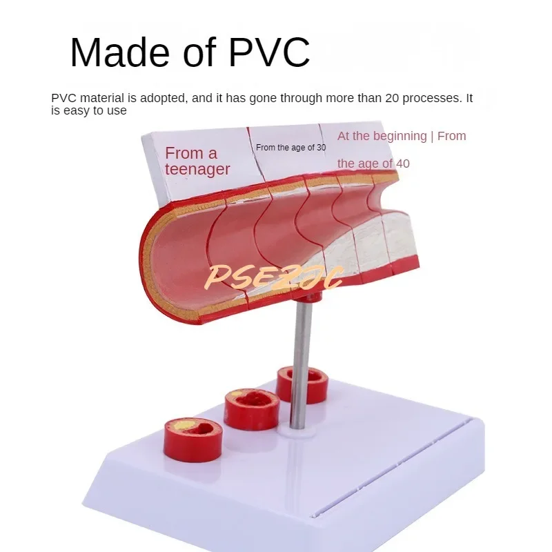 PVC Coronary Cardiovascular Model Sclerosis Elderly Heart  Vascular  Medical Teaching Supplies