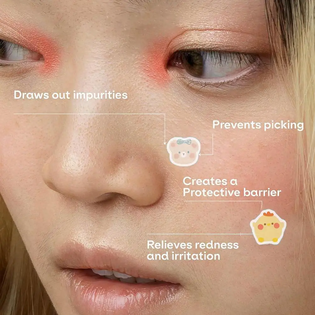 100 個にきびパッチ漫画クマ柄除去ニキビステッカー PE 軽量快適な通気性フェイシャルスキンケアツール