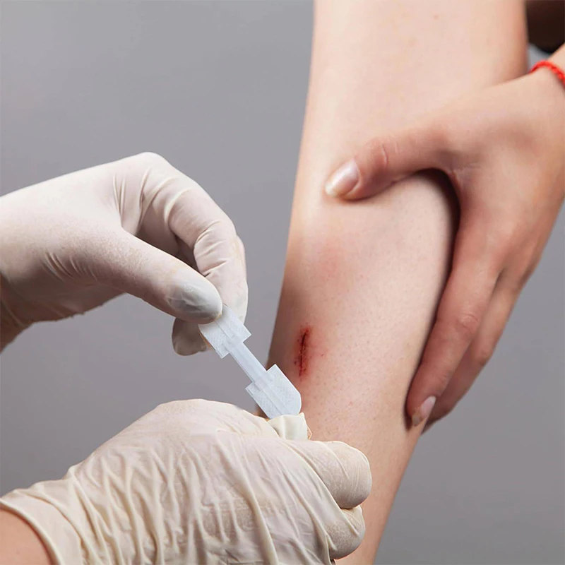 سستة الفرقة المعونة غير مؤلم الجرح إغلاق التصحيح خالية من خياطة تضميد الجروح بقع البريدي خياطة المخفض الفرقة المعونة في الهواء الطلق المحمولة #5