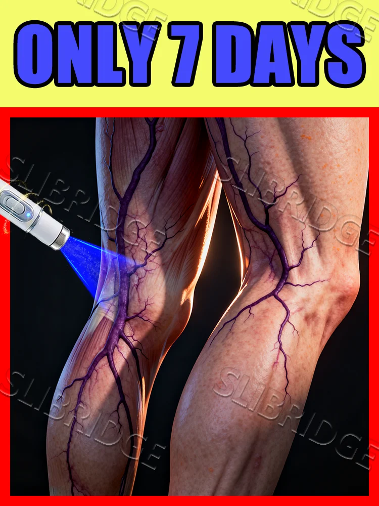 

blue light pen solve veins,veins care tools,free shipping