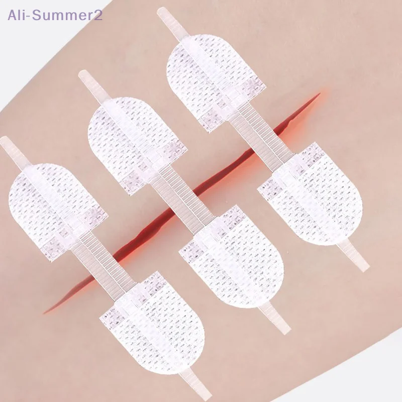 

Strap Zipper Wound Closure Patches Breathable Seamless Elastic Zip Sutures Bandages For Wound Care Braces Supports