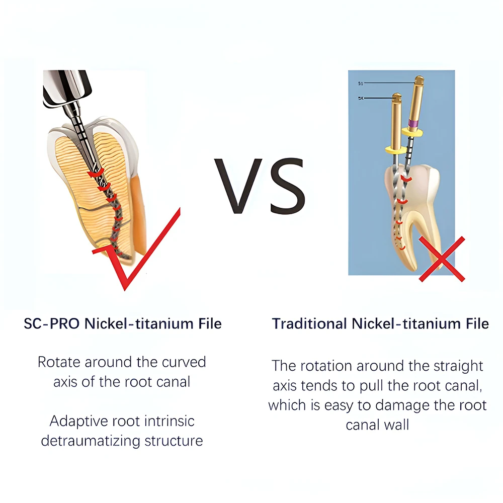 COXO SOCO PRO Dental Root Canal File Heat-Activated Rotary Nitinol Tooth Pulp Files Thermally Activated Nickel-Titanium 6Pcs/Box