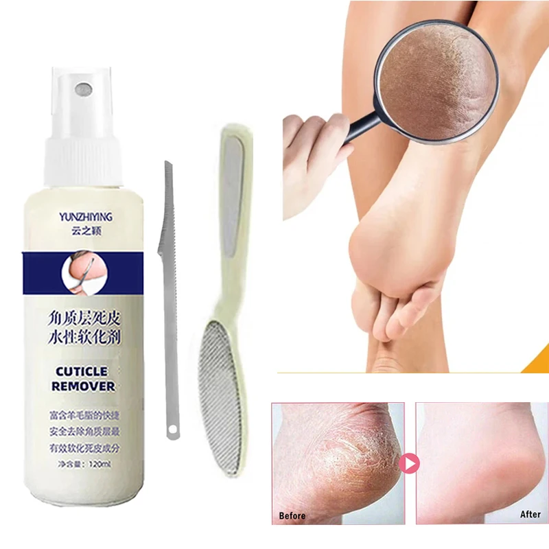 120ml Foot Exfoliator Spray Softener 6 Seconds Remove Dead Skin & Calluses Foot Mask Anti-Cracked Heel Enhancer Nail PedicureKit