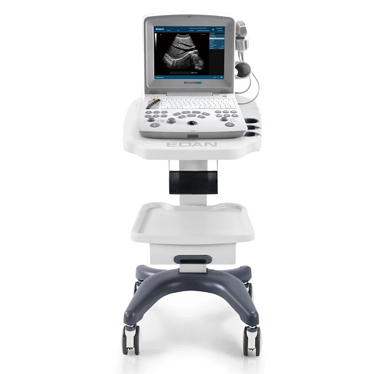 Edan DUS-60 Ultrasound Machine Laptop Edan Ultrasound Portable Ultrasound Machine