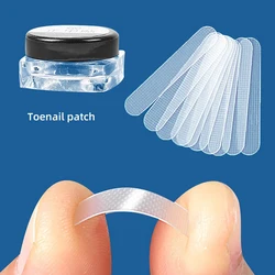 10Pcs Ingrown Toe Nail Treatment Ingrown Toenail Correction Tool Elastic Patch Sticker Straightening Clip Brace Pedicure Tools