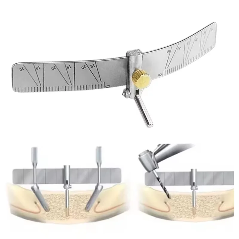 

Стоматологические инструменты, руководство по определению местоположения зубного имплантата, локатор для позиционирования хирургических посадки, угловая линейка, измерительный прибор, автоклавируемый