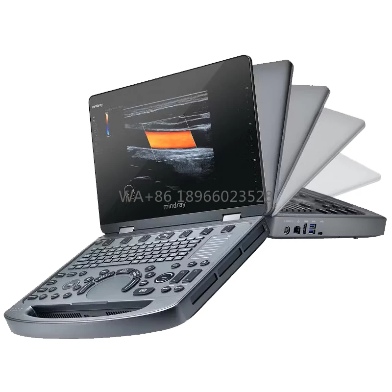 Máquina de Ultrasonido para Terapia, Instrumento Médico, Mindray MX6 Portátil de Alta Resolución