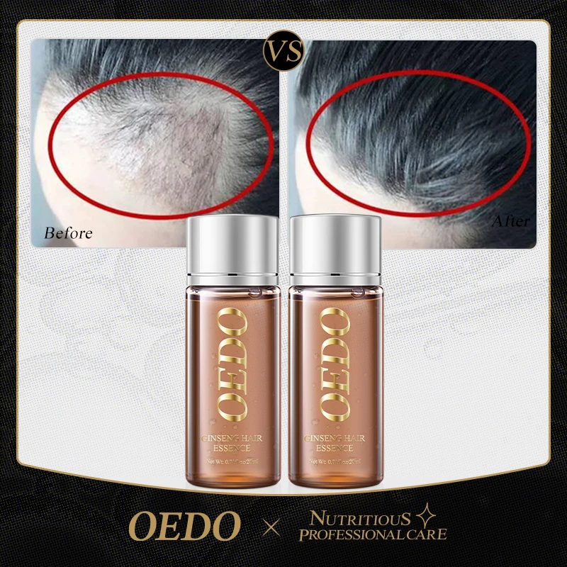 OEDO Prevention of alopecia, nourishing hair, promoting rapid growth of hair, repairing hair and nursing care of hair