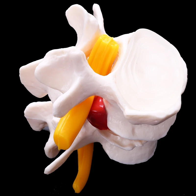 Esqueleto de coluna vertebral, Esqueleto de anatomia humana com 4 estágios, coluna vertebral lombar, modelo fonte de ensino de trauma