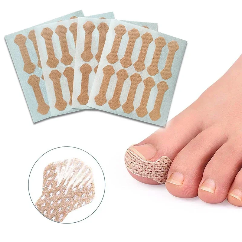 10 pièces de bandes correctrices anti-onychomycose pour ongles incarnés, patchs pour les pieds, patchs pour ongles incarnés pendant le sommeil, coussinets longs pour orteils