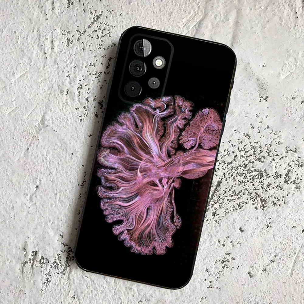 Medical Human Anatomy  Phone Case For Samsung Galaxy A13,21s,22,31,32,52,53,71,80,91 Soft Black Cover