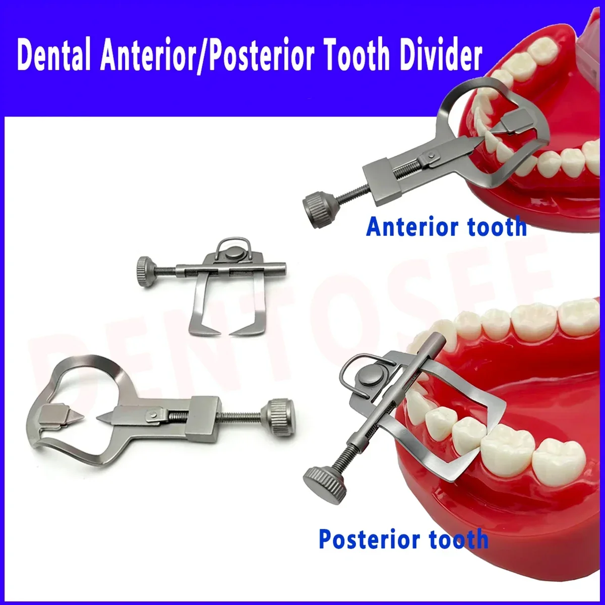 

Dental Orthodontic Anterior/Posterior Tooth Divider Separator Retractor Retainer Matrix Rubber Dam Dentist Tooth Separation Tool