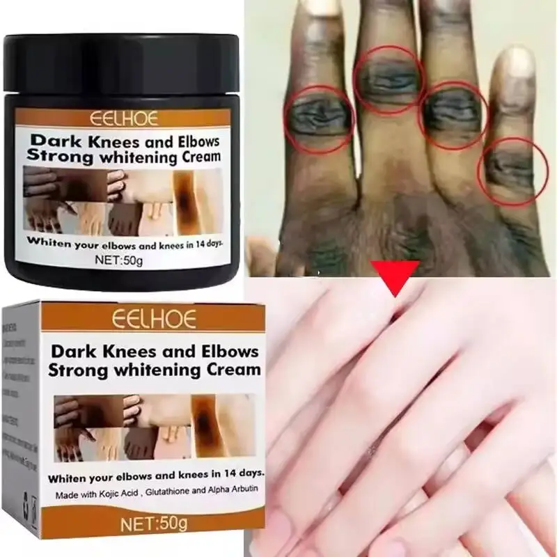 

Dark Knuckles Fast Brighten Cream Elbows Hand Knuckle Brightening Serum Knee Black Skin Quickly Lighten Stains Remover Products