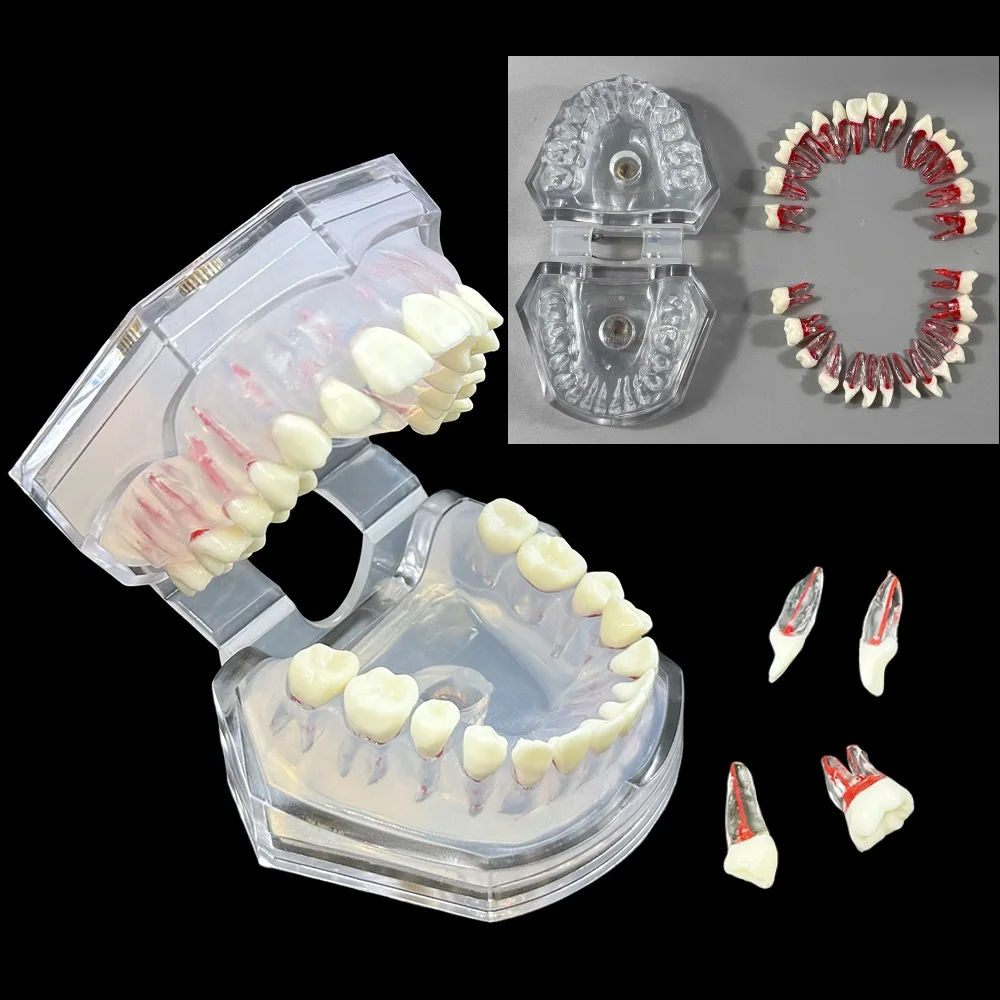 

Dental Typodont Model With 28pcs Full Mouth Resin Root Canal Tooth Practice Blocks Model Endo Pulp Cavity Study Teeth Jaw Model